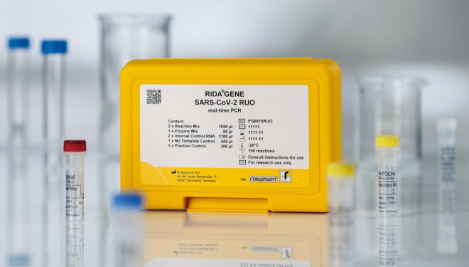 Тернопільська міська рада придбали ПЛР-тести для виявлення COVID-19