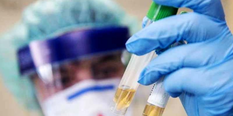 Позитивна динаміка: у Тернополі йде на спад рівень захворюваності на COVID-19