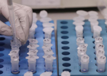 У Тернополі можна зробити тест на наявність антитіл до коронавірусної інфекції