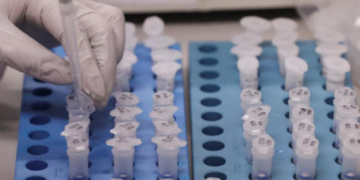 У Тернополі можна зробити тест на наявність антитіл до коронавірусної інфекції