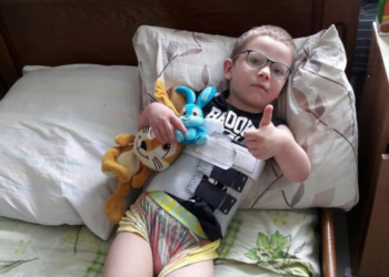 Через сильні болі у ногах дитина вставати не може: тернополян просять допомоги