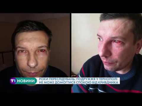 Роки переслідувань: пара у Тернополі потерпає через напади та погрози