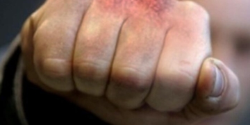 Конфлікт інтересів: на Тернопільщині голова громади вдарив секретаря