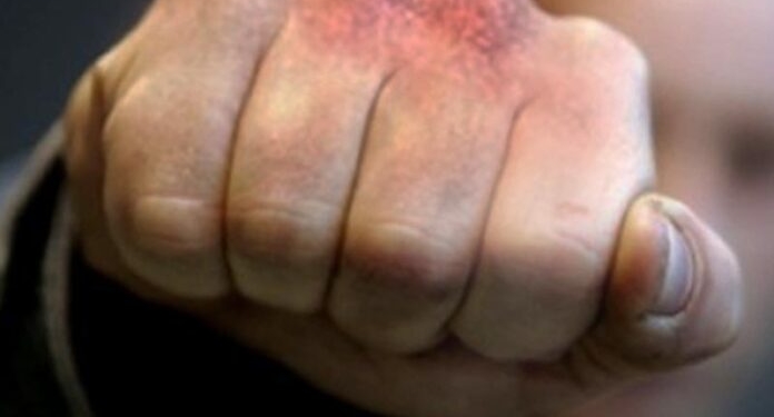 Конфлікт інтересів: на Тернопільщині голова громади вдарив секретаря