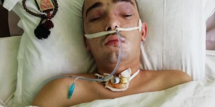 У постраждалого в ДТП Максима Беспалова з Кременця запалення мозку – потрібна допомога