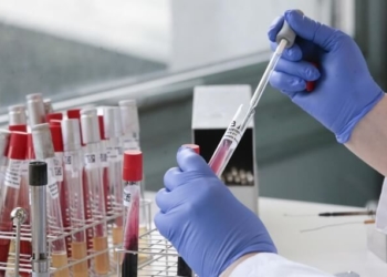 Жоден пацієнт, який має покази до ПЛР-тестування, не повинен за нього платити