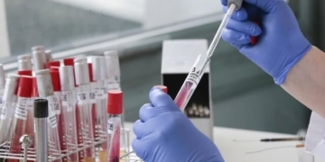 Жоден пацієнт, який має покази до ПЛР-тестування, не повинен за нього платити