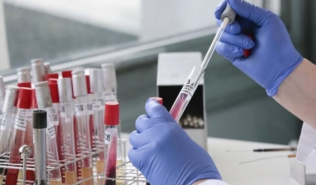 Жоден пацієнт, який має покази до ПЛР-тестування, не повинен за нього платити