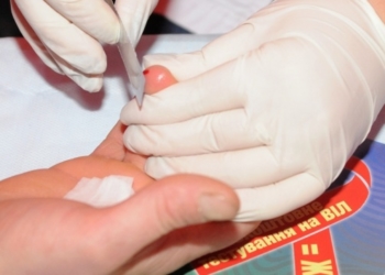 Протягом тижня у Тернополі можна безкоштовно протестуватися на ВІЛ та гепатит С