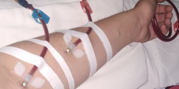 Житель Тернопільщини Ігор Собчук бореться за життя