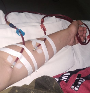 Житель Тернопільщини Ігор Собчук бореться за життя