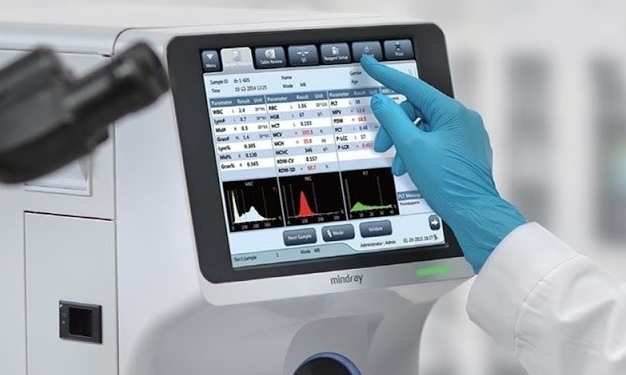 Для потреб тернополян благодійники придбали сучасний аналізатор крові