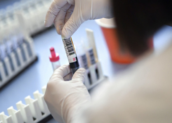 Коронавірусна статистика: на Тернопільщині фіксують зменшення кількості хворих