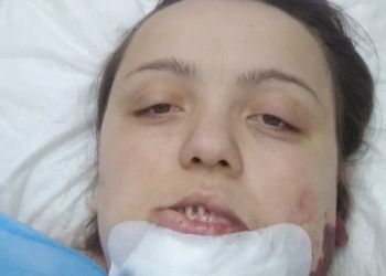 Три операції позаду, ще дві – попереду: допомоги потребує мама трьох дітей Наталя Борисюк