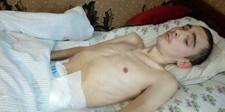 На Тернопільщині 24-річний мотоцикліст розбився у ДТП: стан хлопця важкий, потрібна допомога