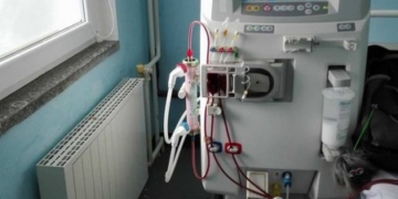 Доступне лікування: у Тернопільську лікарню придбали нове обладнання