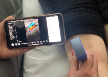 У Тернопільській університетській лікарні з’явився сучасний мобільний апарат УЗД, менший за телефон