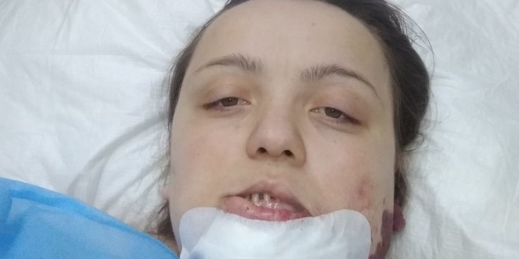 На Тернопіллі мама трьох дітей благає про допомогу