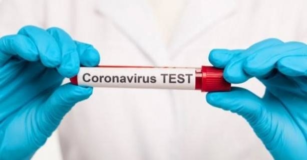 Слідчі оголосили про підозру двом жителям Тернополя у підробленні ПЛР-тестів (Відео)