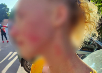 Бійка посеред білого дня у Тернополі, – жінка побила перехожу та втекла у невідомому напрямку