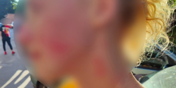 Бійка посеред білого дня у Тернополі, – жінка побила перехожу та втекла у невідомому напрямку