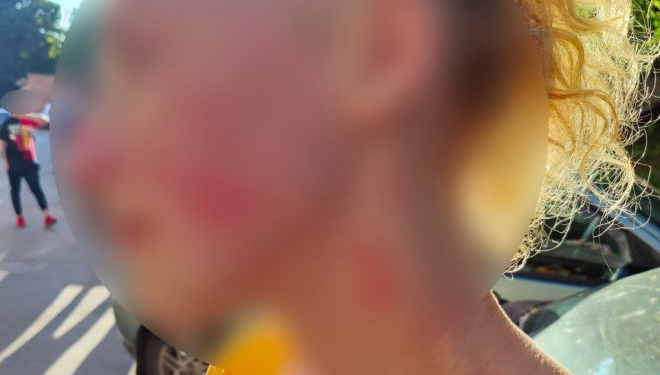 Бійка посеред білого дня у Тернополі, – жінка побила перехожу та втекла у невідомому напрямку