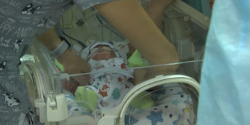 У Тернопільському пологовому народився малюк вагою 560 грамів