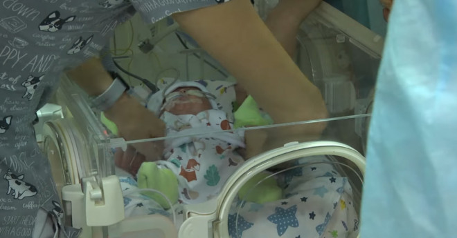 У Тернопільському пологовому народився малюк вагою 560 грамів