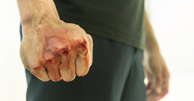 Тернополянину який побив муніципала загрожує 5 років в’язниці