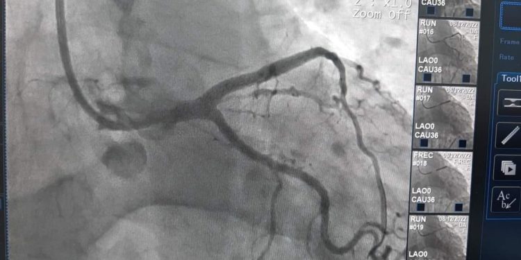 Унікальну процедуру на серці вперше виконали в Тернопільській лікарні