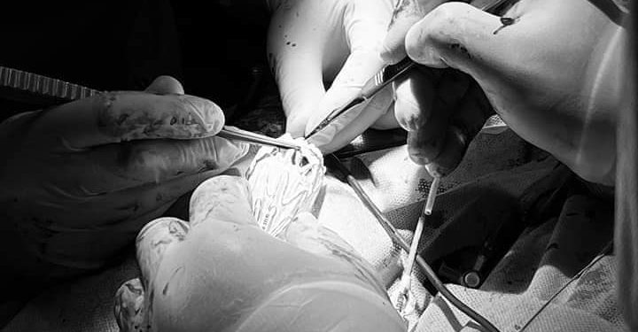 Тернопільські хірурги провели рідкісну операцію