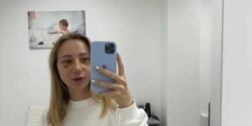 Дружина відомого тернопільського співака хизується пластичною операцією