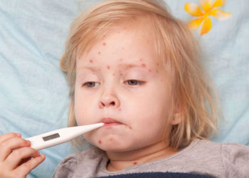 В дітей на Тернопільщині виявили кір: у навчальних закладах краю посилюють протиепідеміологічні заходи