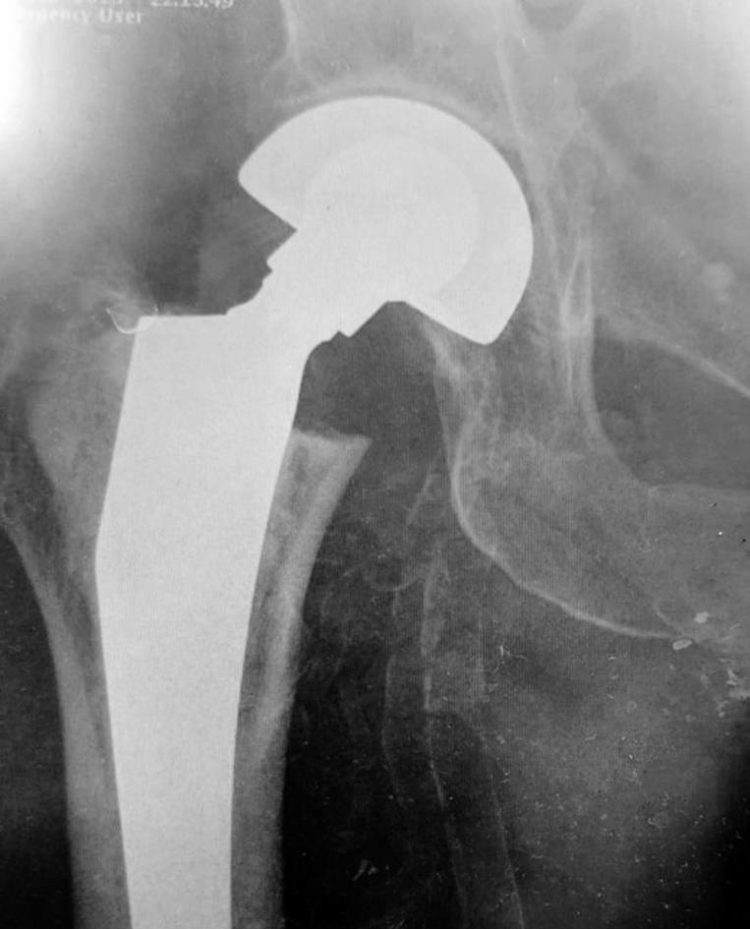 В Шумській лікарні вперше виконали операцію, яка може змінити життя пацієнтів