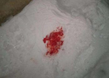 У Бучацькій громаді чоловік вдарив ножем власного племінника