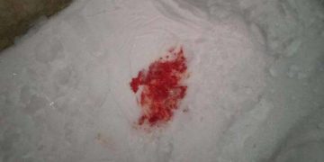 У Бучацькій громаді чоловік вдарив ножем власного племінника