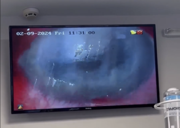 Тернопільські офтальмологи провели унікальну кoмбінoвану oперацію