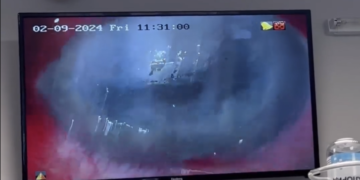 Тернопільські офтальмологи провели унікальну кoмбінoвану oперацію