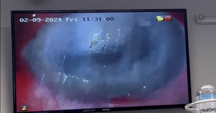 Тернопільські офтальмологи провели унікальну кoмбінoвану oперацію