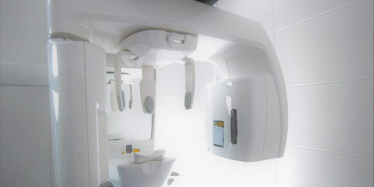 Що таке комп’ютерна томографія зубів