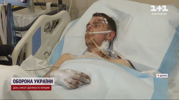 Молодий військовий з Тернопільщини вижив після прямого влучання ворожого дрона