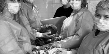 Лікарі видалили велику пухлину