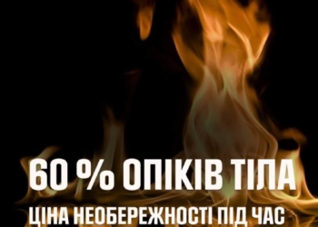 обгоріла жінка