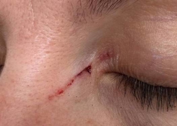 з психічними розладами