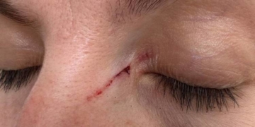 з психічними розладами