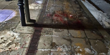 Внаслідок кривавої бійки двоє чоловіків у реанімації