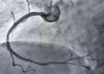 Тернопільські хірурги навчилися чистити артерії