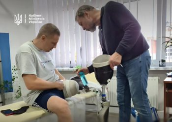 Держава спрощує протезування для українців